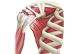 Rotator Cuff Repair
